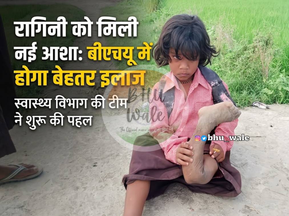 ragini-treatment-bhu-ballia-health-department